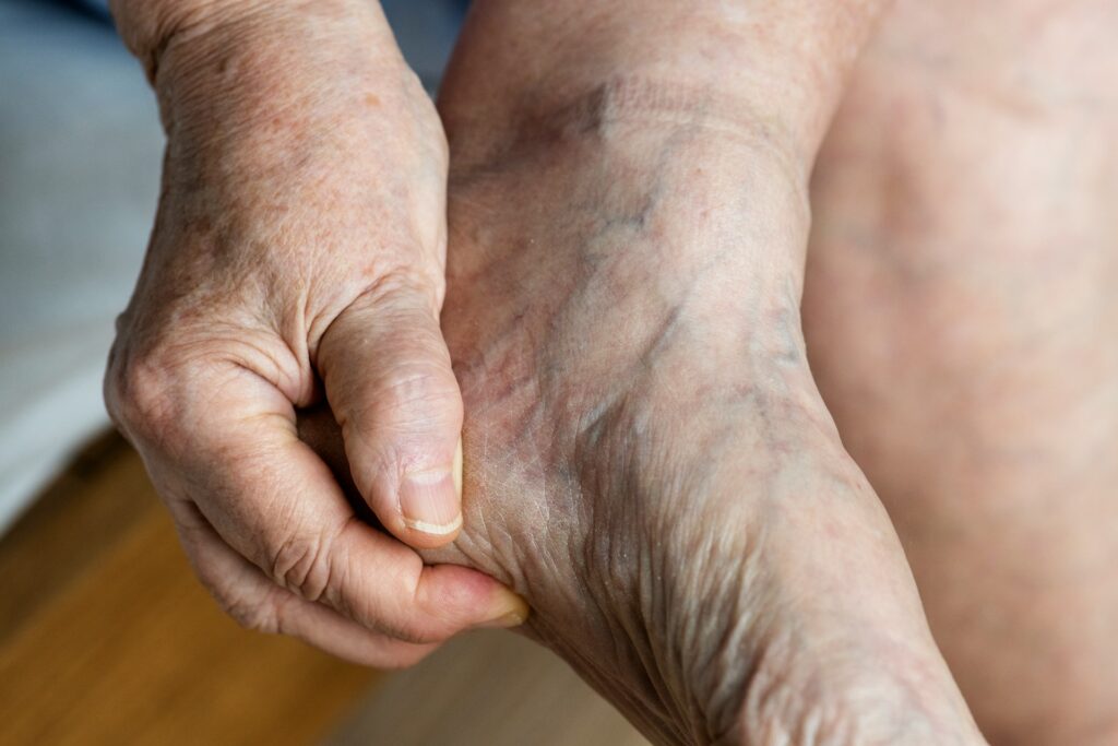 Heel Pain