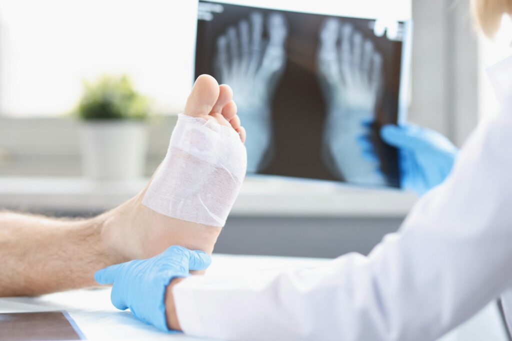 post-surgery foot